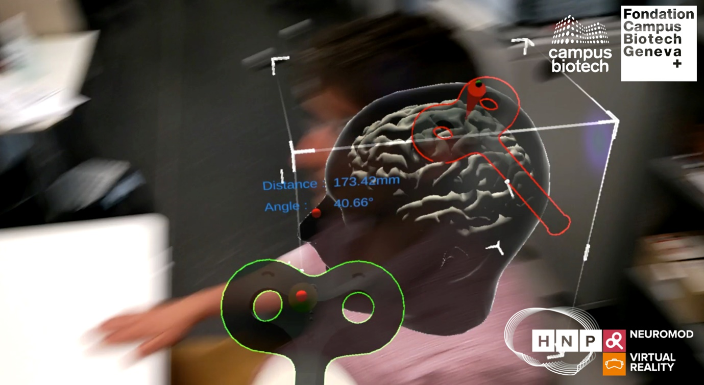Figure 3. Stimulation Transcrânienne cérébrale combine à la Réalité Augmentée